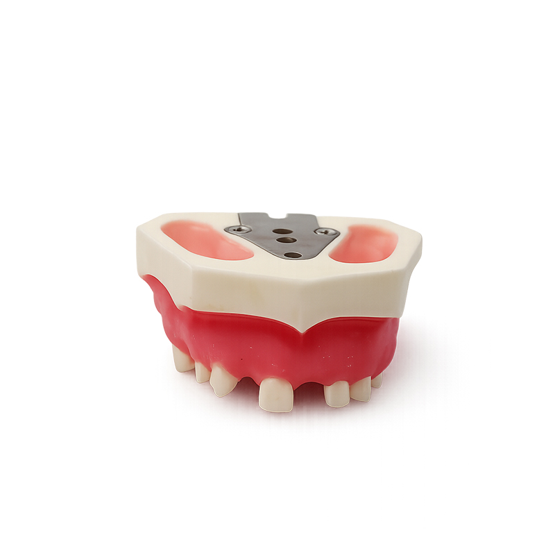 Practice Typodont for Sinus Lift with Gum Bader