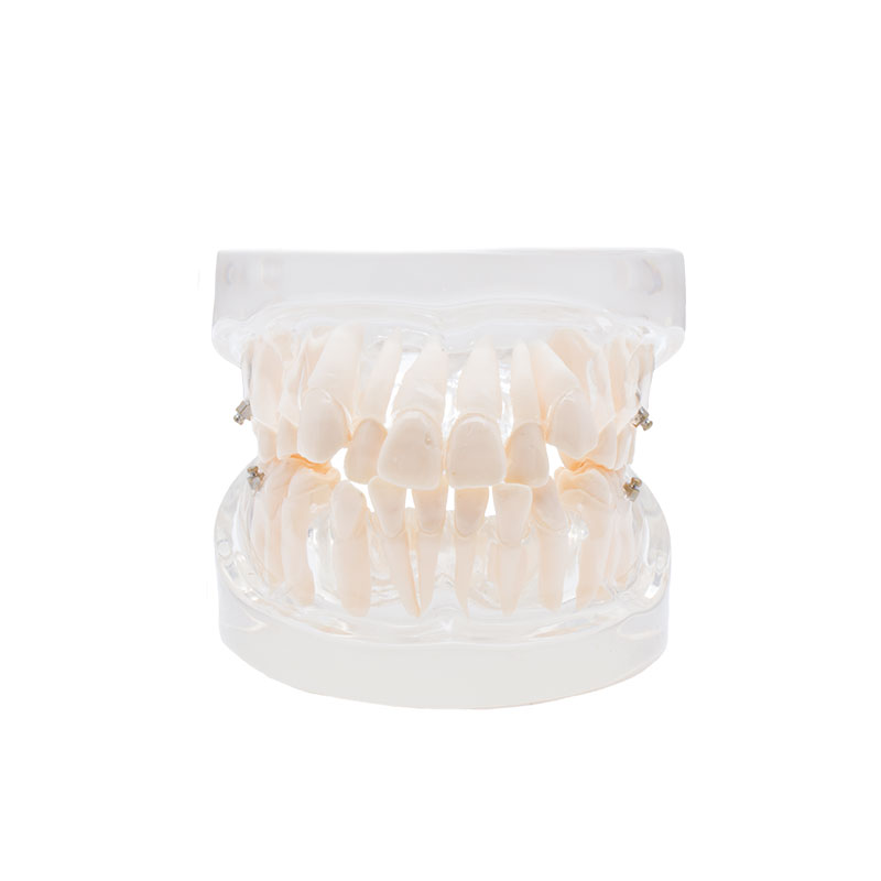 Bader orthodontic practice model