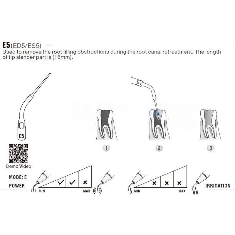 Ultrasonic tip Woodpecker ED5 compatible with Satelec | Endo