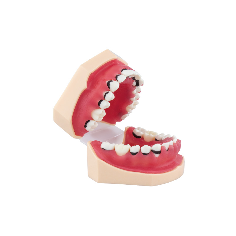 Bader Complete Periodontitis Model