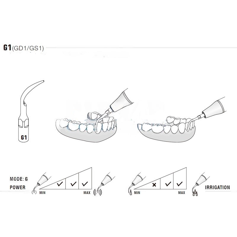 Woodpecker GS1 ultrasonic tip compatible with Sirona | Prophylaxis