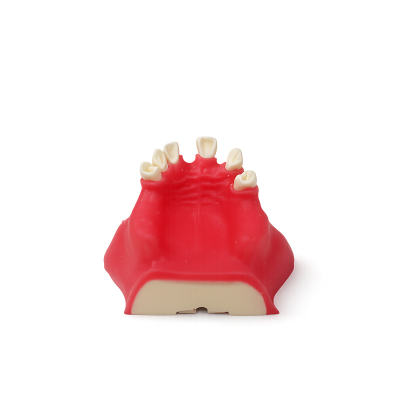 Typodont for Sinus Lift Practice with Gingiva and with Partial Sinus Cavity Bader