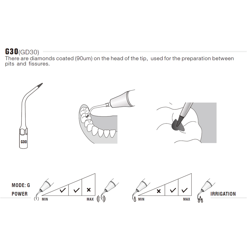 Woodpecker G30 Ultrasonic Tip Compatible EMS | Prophylaxis, Diamond Carving