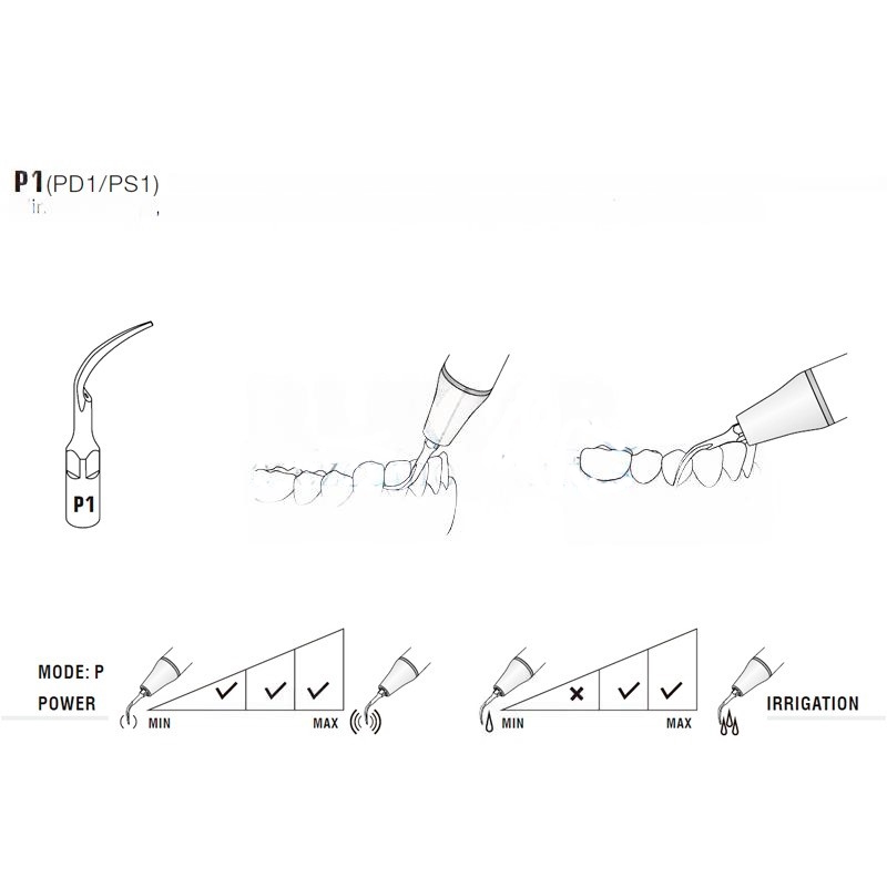 Woodpecker PD1 ultrasonic tip compatible with Satelec | Perio