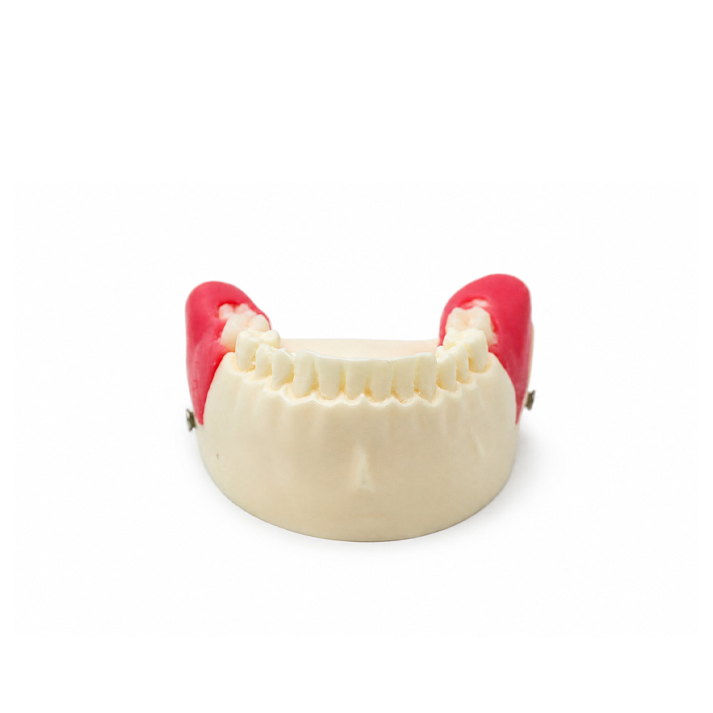 Model of Extraction of Retained and Semi-Retained Teeth Bader