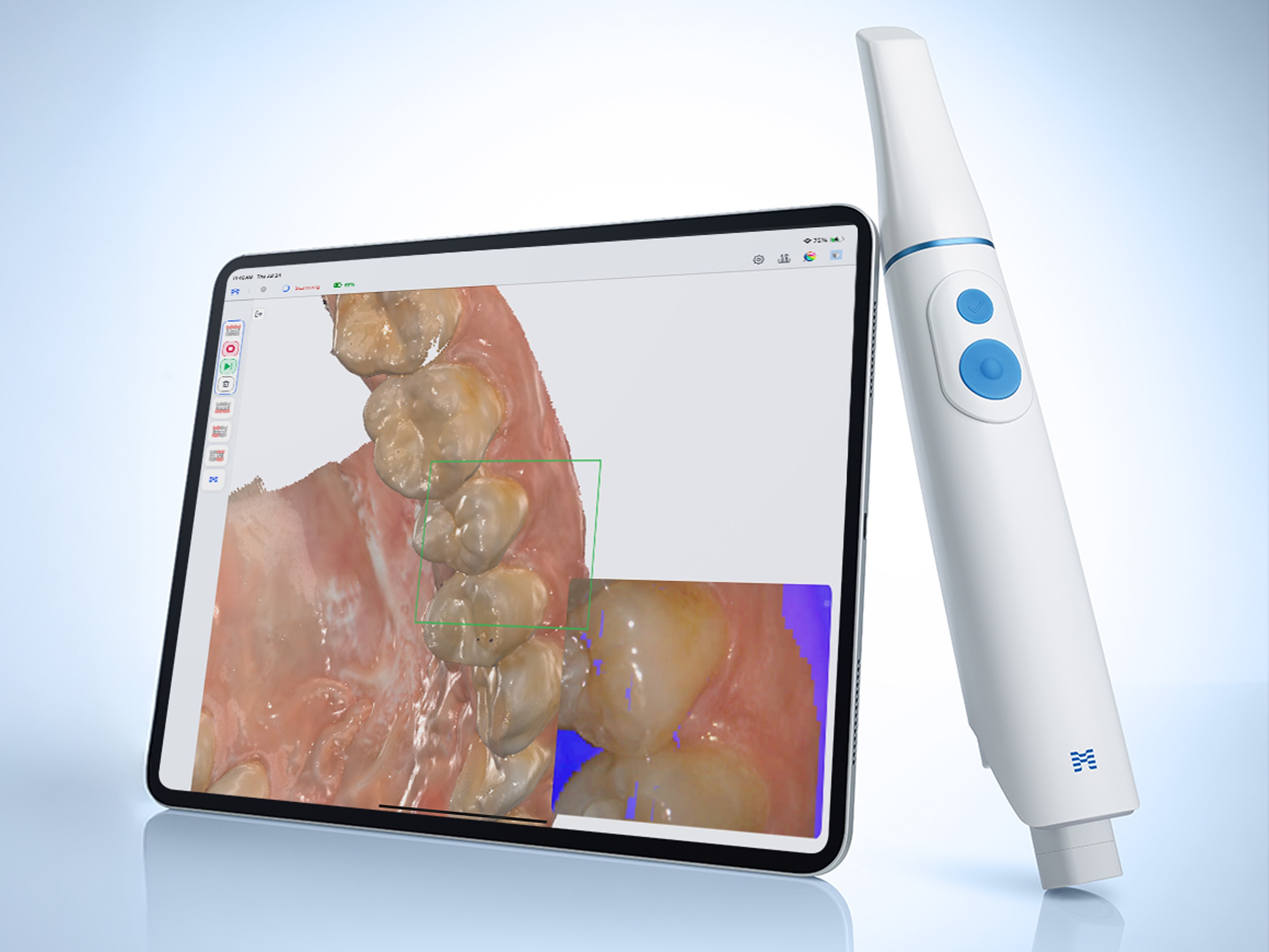 Medit i900 Mobility Intraoral Scanner