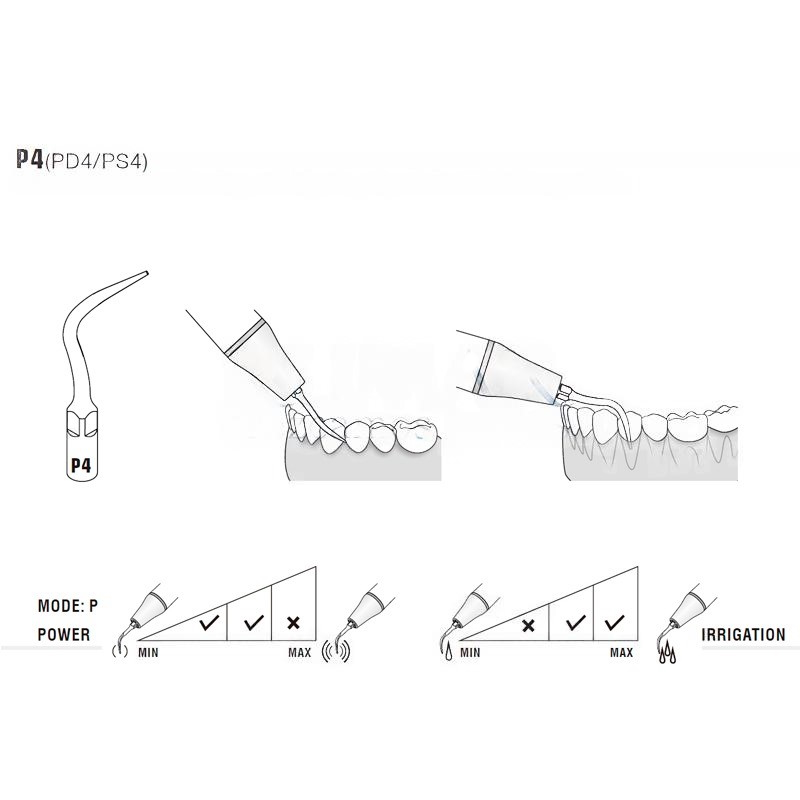 Woodpecker PS4 Ultrasonic Tip Compatible with Sirona | Perio