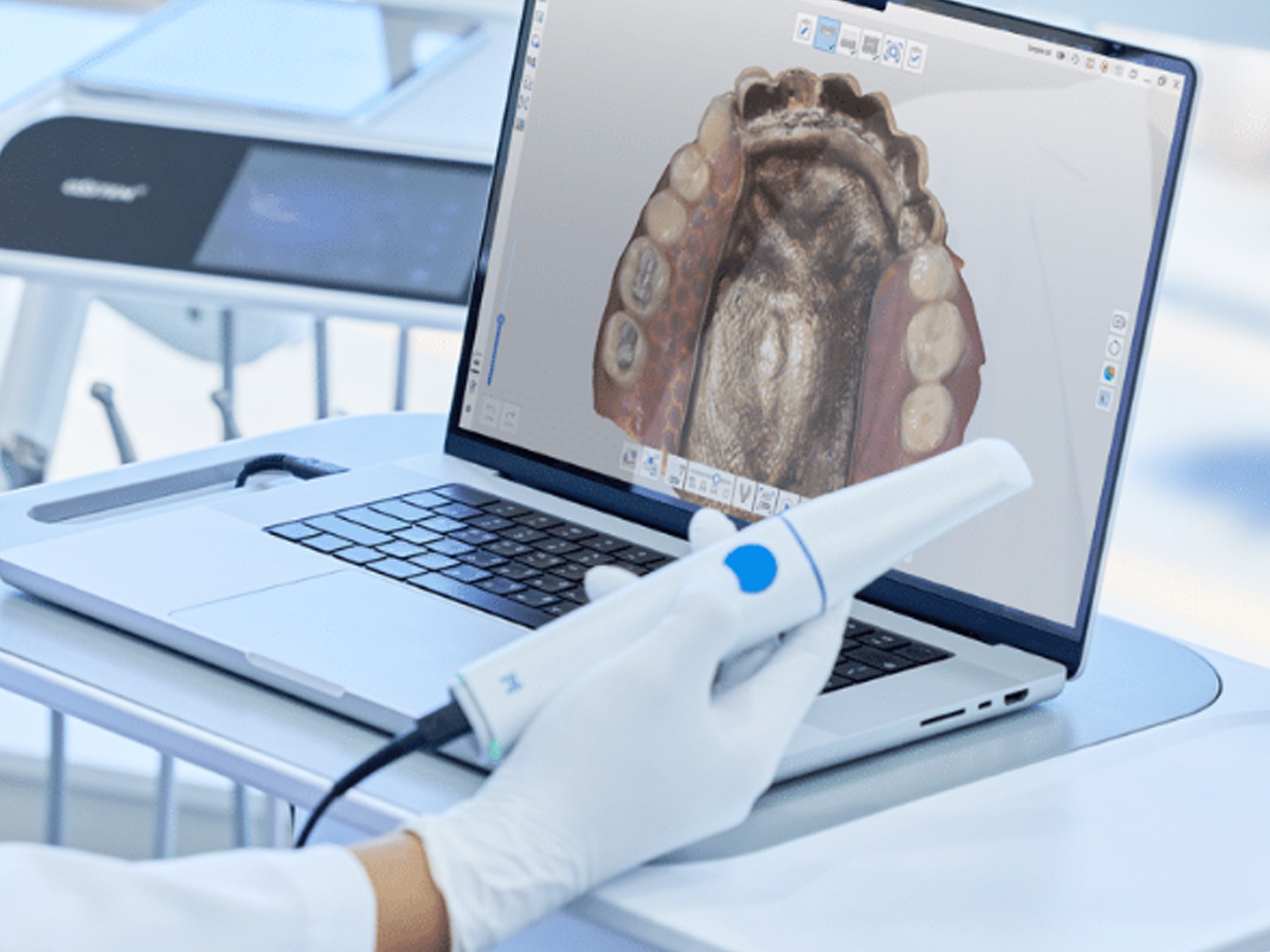 Medit i900 Classic Intraoral Scanner