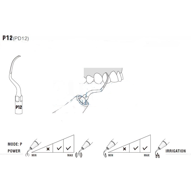 Woodpecker PD12 ultrasonic tip compatible with Satelec | Perio