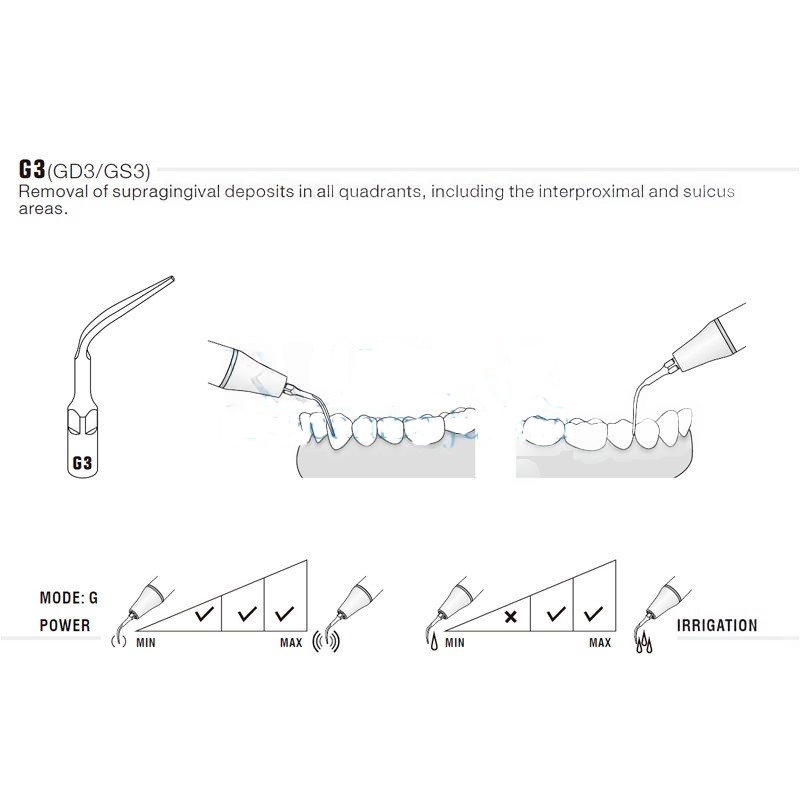 Woodpecker G3 Ultrasonic Tip Compatible EMS | Prophylaxis