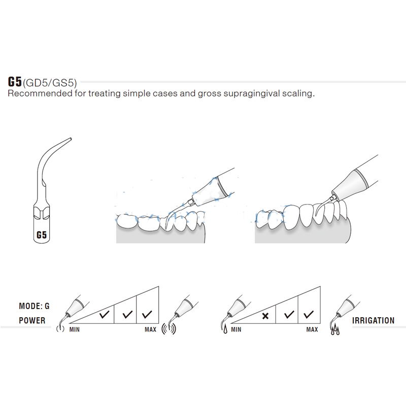 Woodpecker GD5 ultrasonic tip compatible with Satelec | Prophylaxis