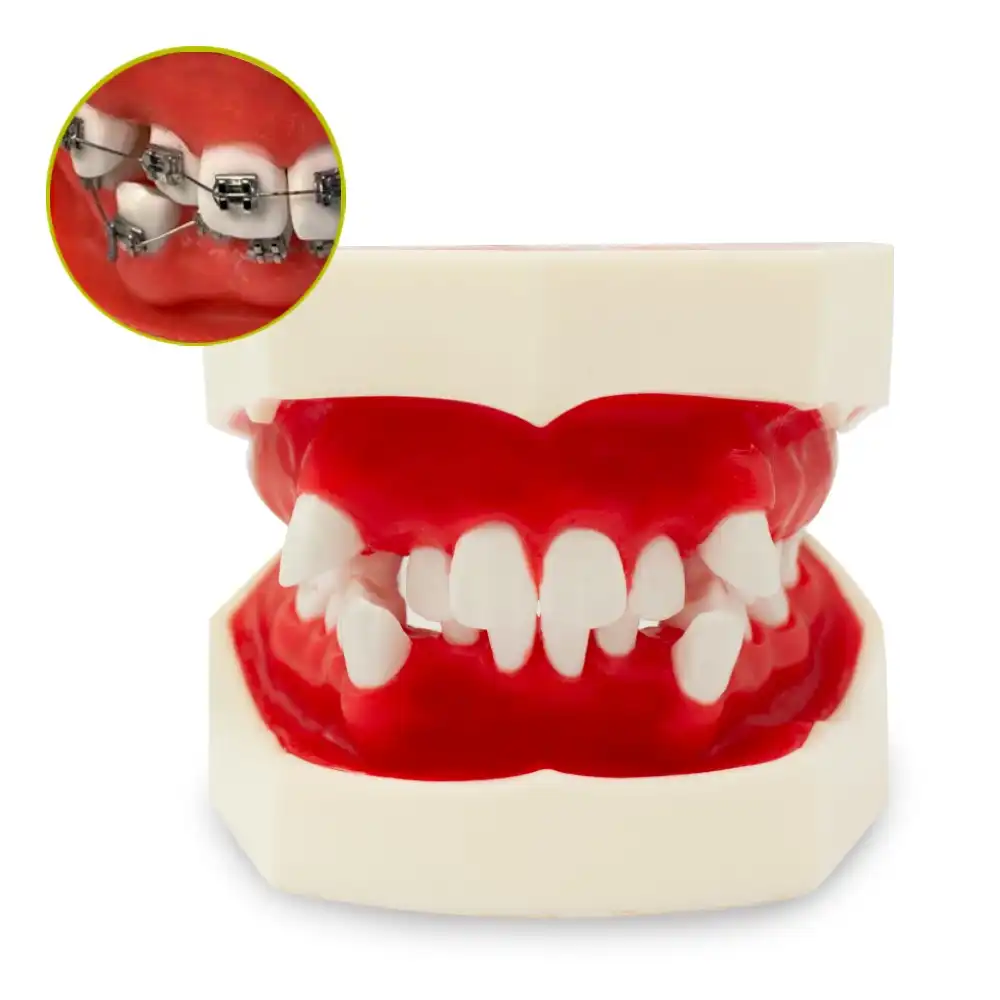 Tipodonto Cemented and Biomedical Orthodontics Bader