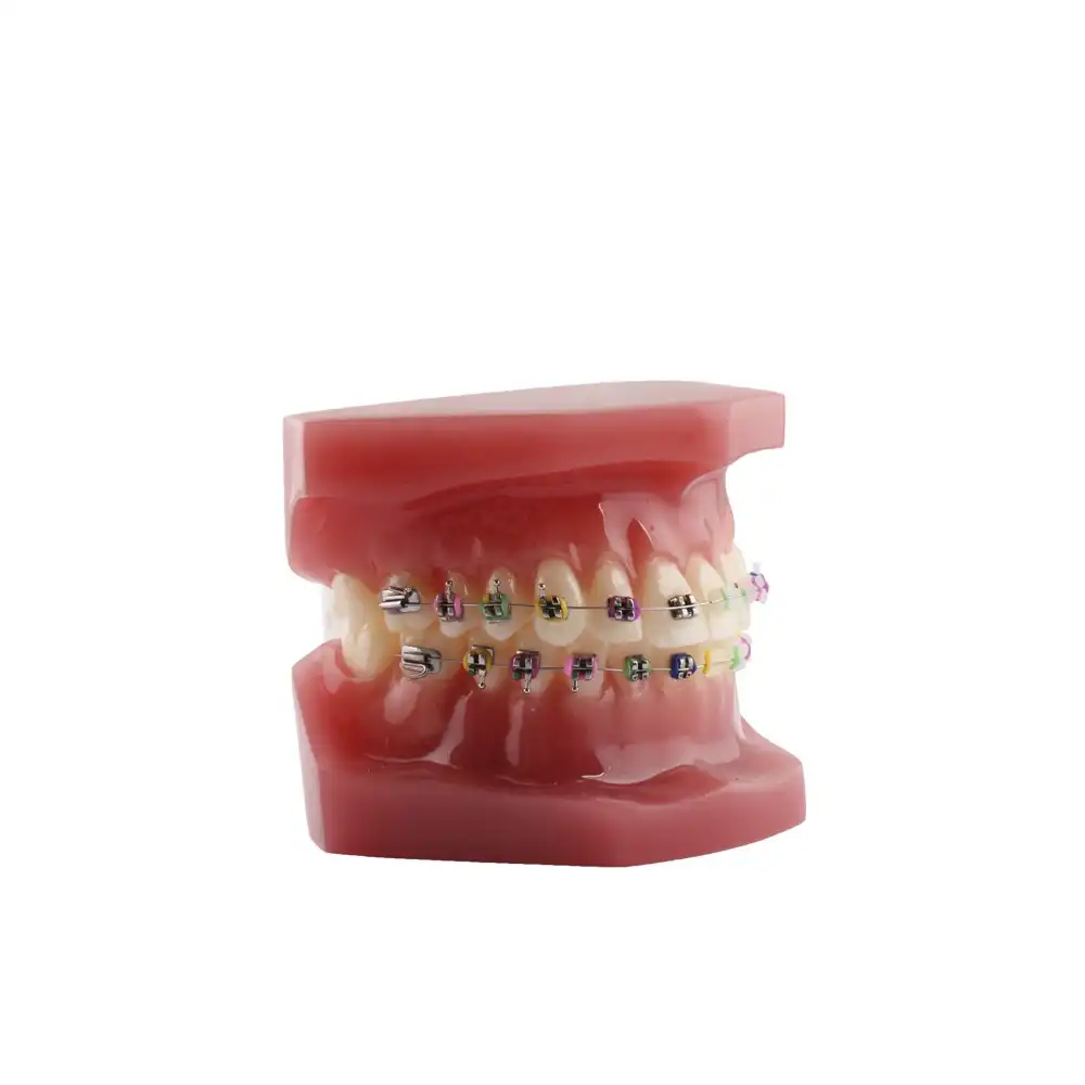 Model Be Bracket Bader