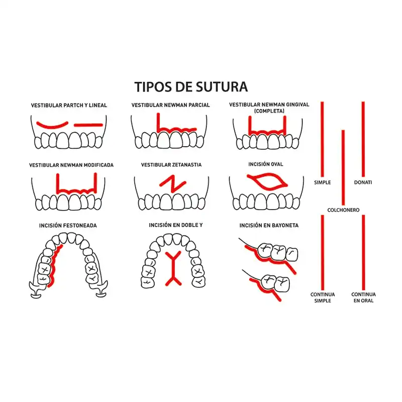 Bader Suture Practice Model