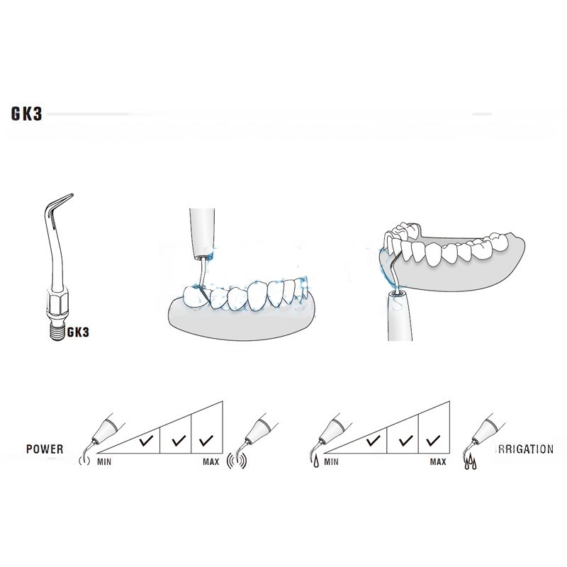 Tip for KaVo Sonicflex 2000N / 2003 and ECO S2 | Prophylaxis