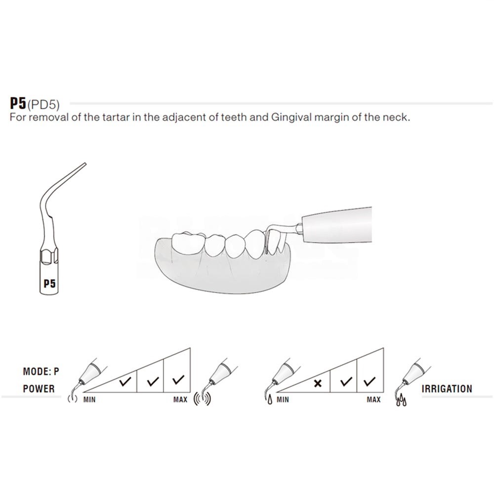 Ultrasonic tip Woodpecker P5 compatible EMS | Perio