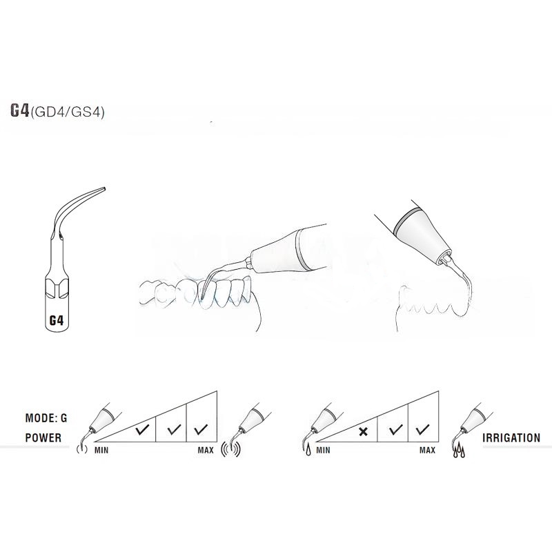 Woodpecker GD4 ultrasonic tip compatible with Satelec | Prophylaxis