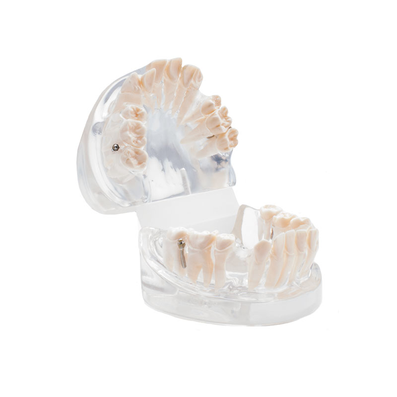 Bader orthodontic practice model