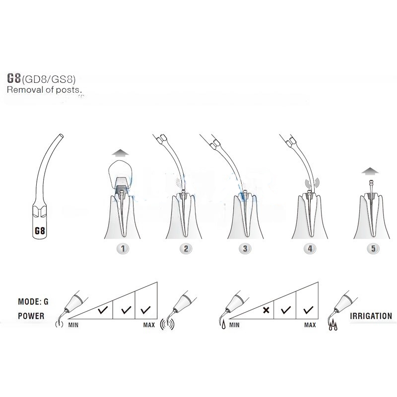 Woodpecker GD8 ultrasonic tip compatible with Satelec | Prophylaxis