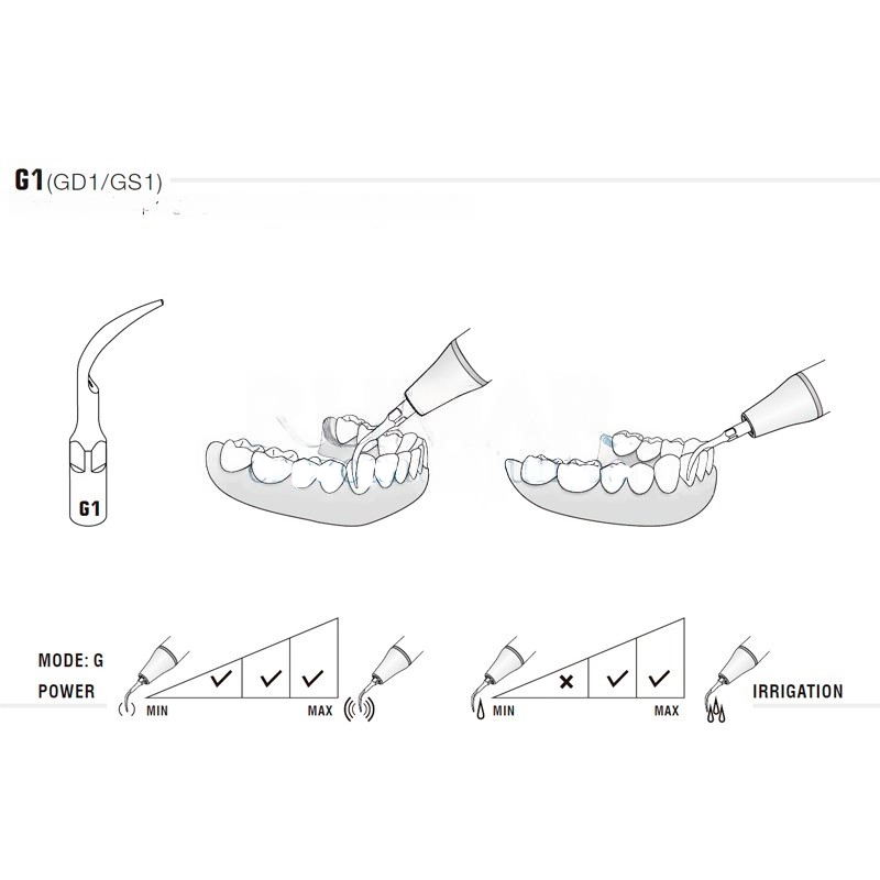 Woodpecker GD1 Ultrasonic Tip Compatible Satelec | Prophylaxis