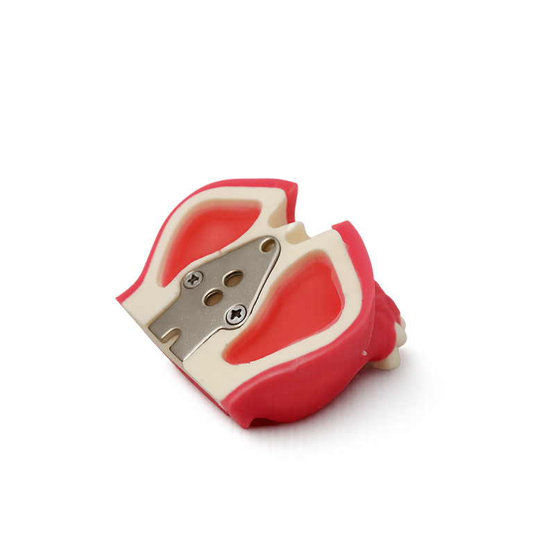 Typodont for Sinus Lift Practice with Gingiva and with Partial Sinus Cavity Bader