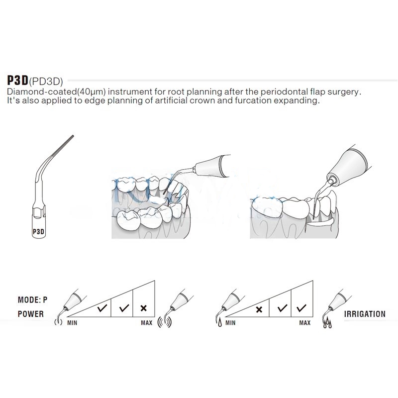 Woodpecker P3D ultrasonic tip compatible with EMS | Perio, Diamond-coated