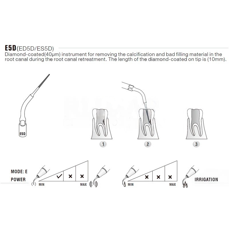 Woodpecker E5D ultrasonic tip compatible with EMS | Endo, Diamond