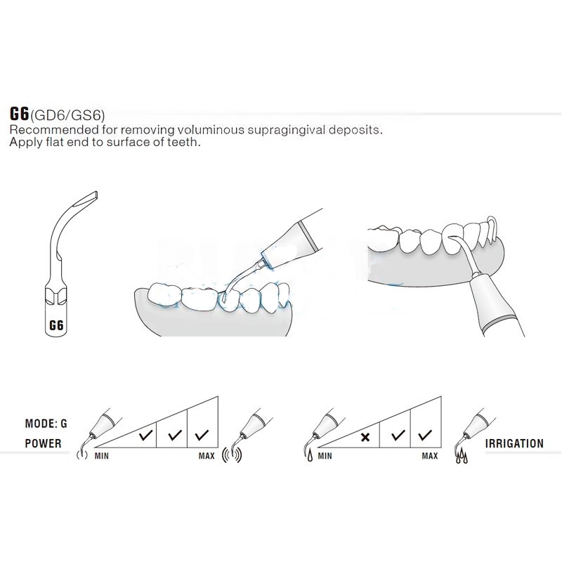Woodpecker GD6 ultrasonic tip compatible with Satelec | Prophylaxis
