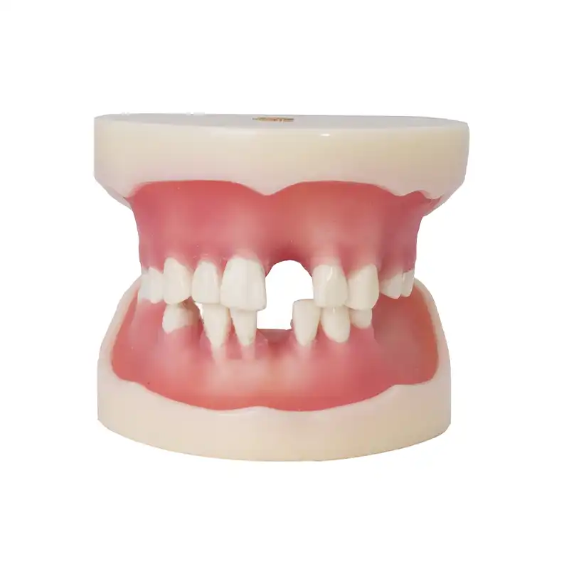 Typodont for Implantology with Articulator Bader