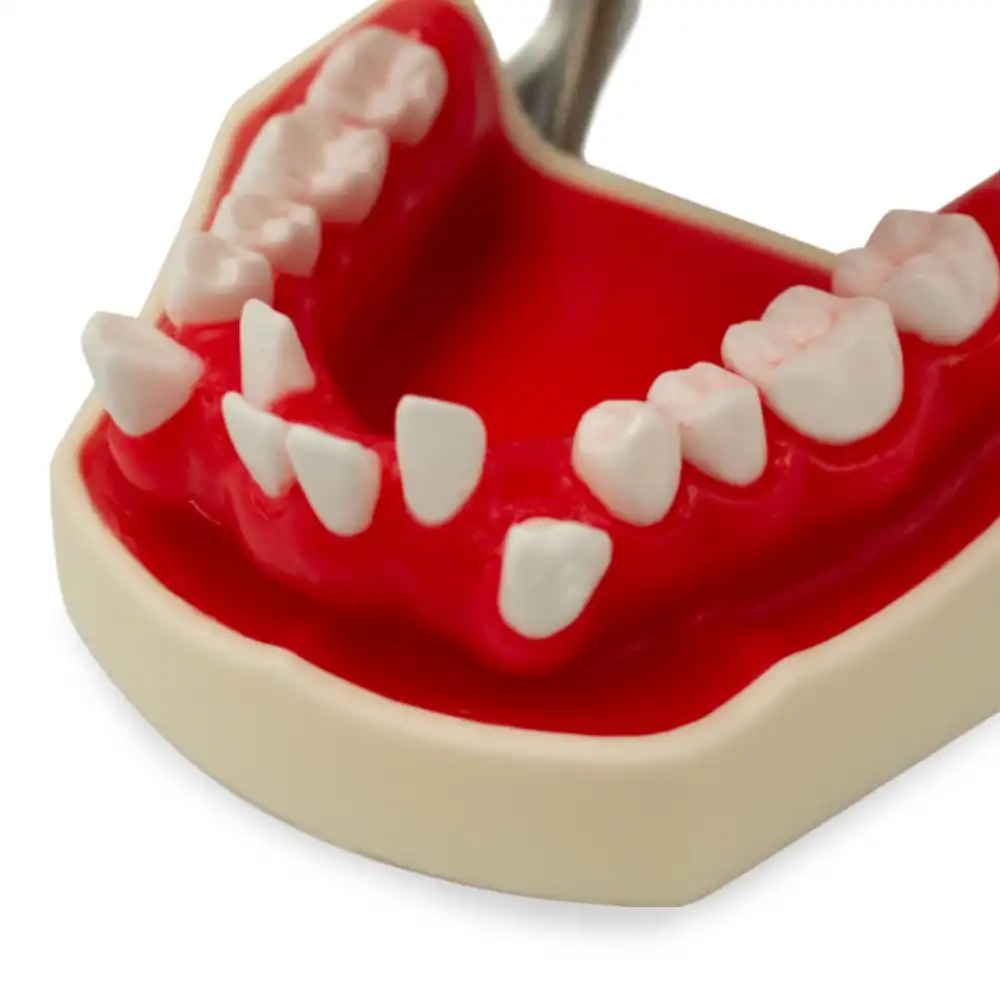 Tipodonto Cemented and Biomedical Orthodontics Bader