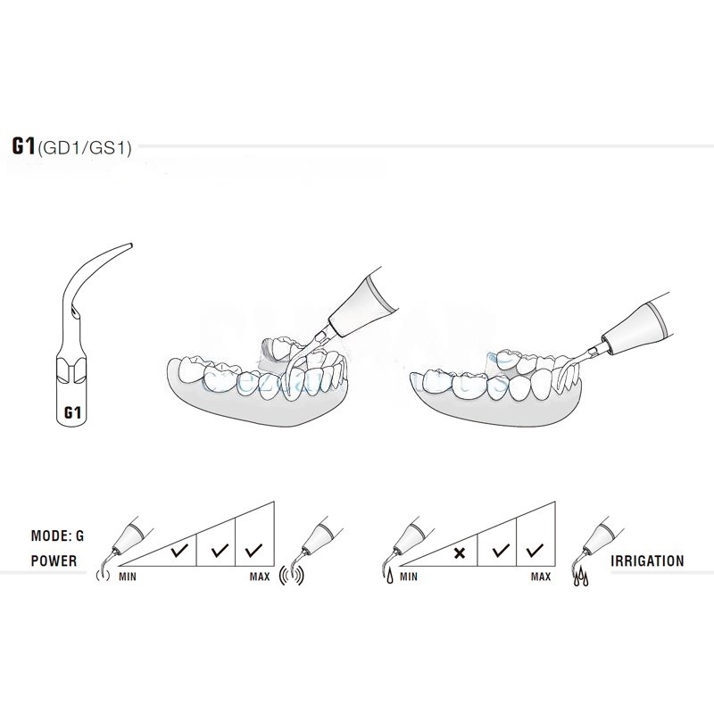 Ultrasonic tip Woodpecker G1 compatible EMS | Prophylaxis
