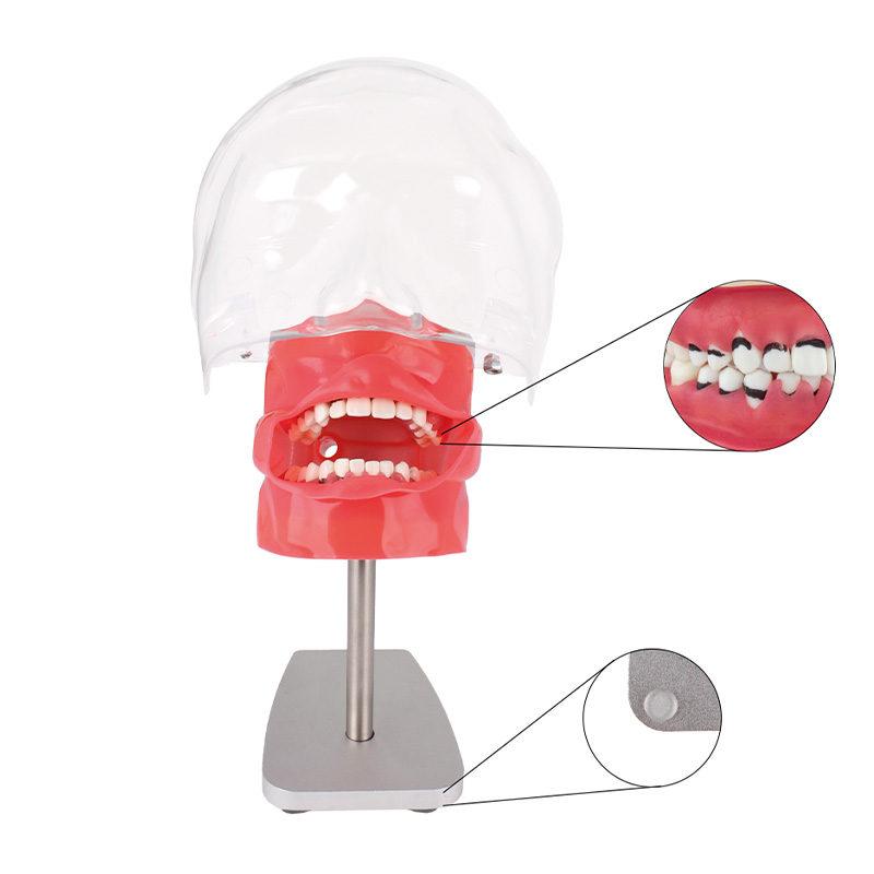 Periodontics Phantom Bader for Table