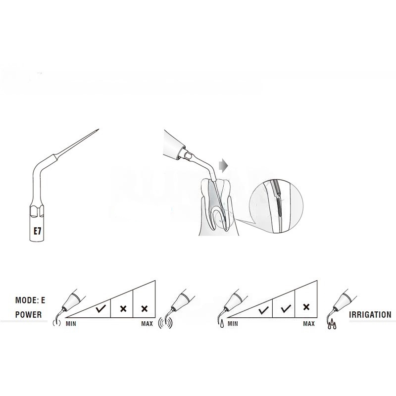 Woodpecker ED7 ultrasonic tip compatible with Satelec | Endo