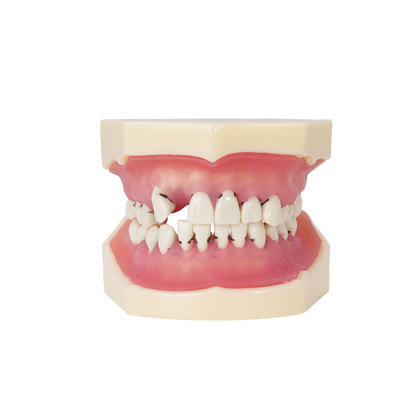 Bader periodontics model