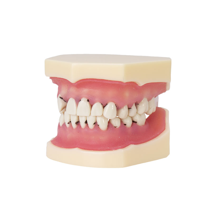 Bader periodontics model