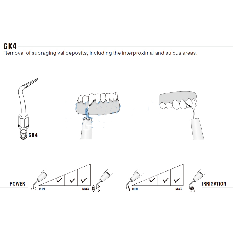 Extra long tip for KaVo Sonicflex 2000N / 2003 and ECO S2 | Prophylaxis