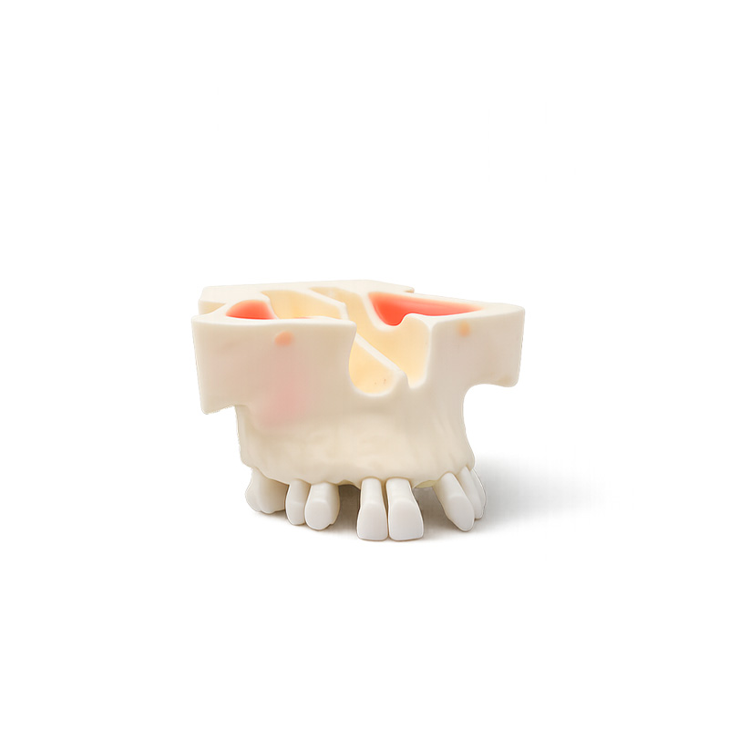 Bader Typodont for Maxillary Sinus Lift Practice in Implants with Zygomatic Bone