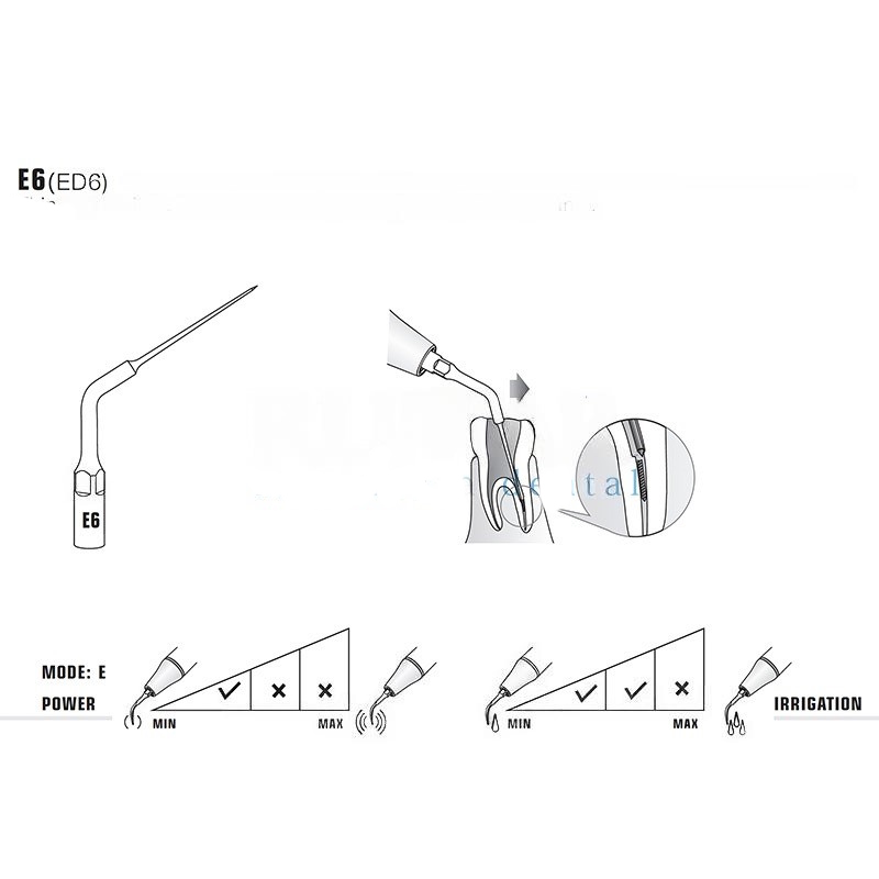 Ultrasonic tip Woodpecker E6 compatible with EMS | Endo