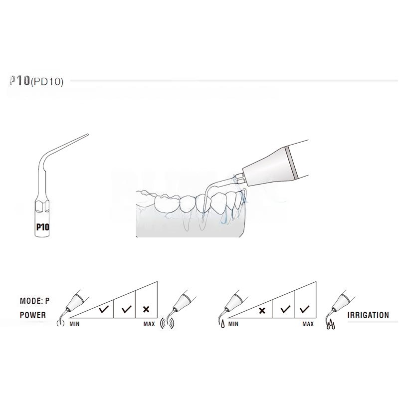 Woodpecker P10 Ultrasonic Tip EMS Compatible | Perio