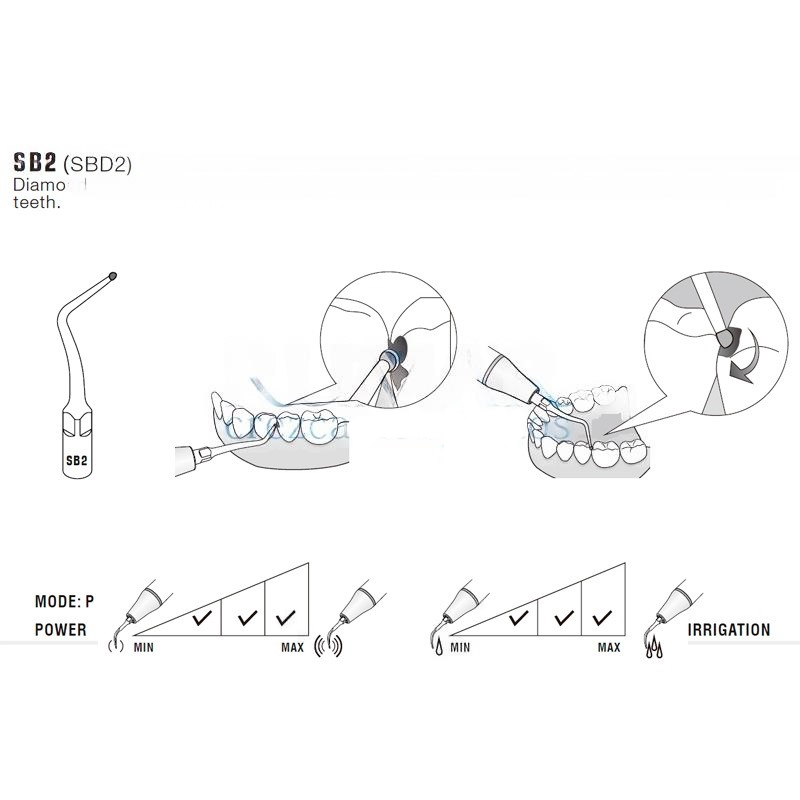 Ultrasonic Tip Woodpecker Sbd2 Compatible With Satelec | Cavities, Diamond
