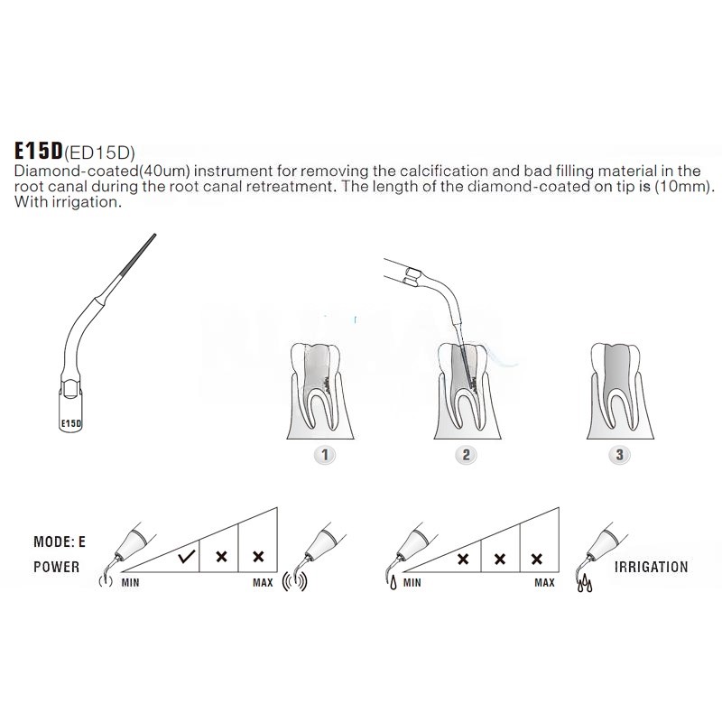 Woodpecker E15D Ultrasonic Tip Compatible With EMS | Endo Diamond