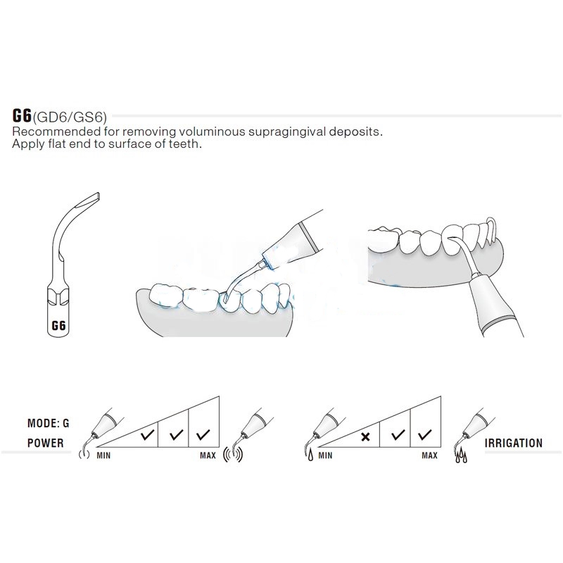 Woodpecker G6 ultrasonic tip compatible EMS | Prophylaxis