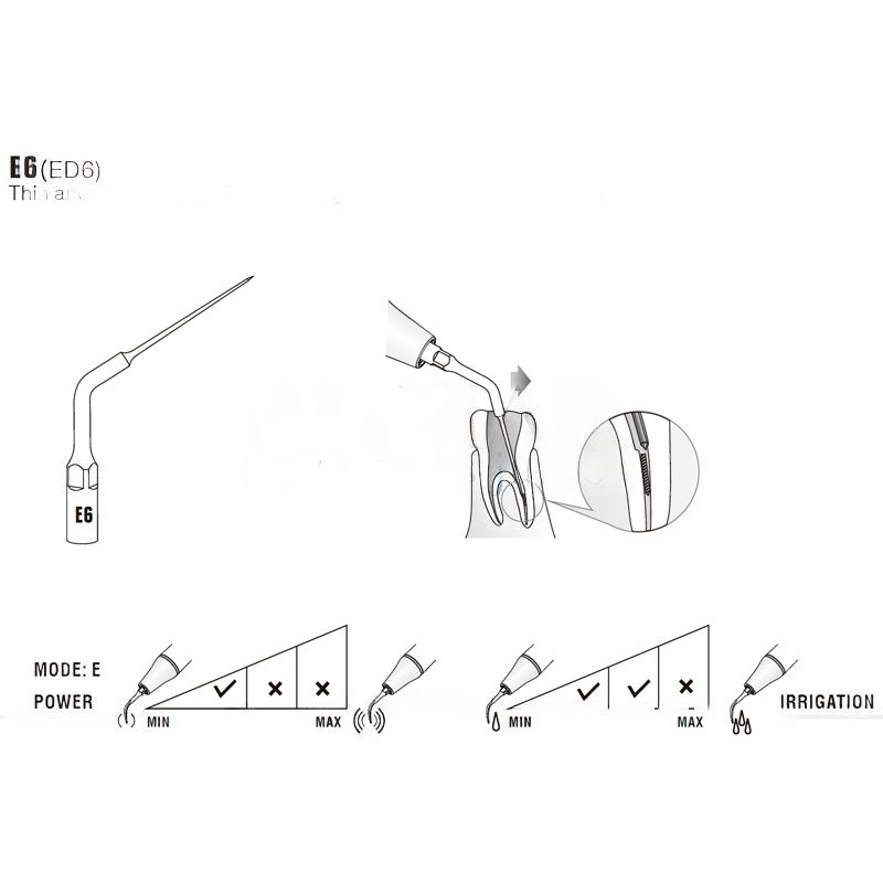 Ultrasonic tip Woodpecker ED6 compatible Satelec | Endo