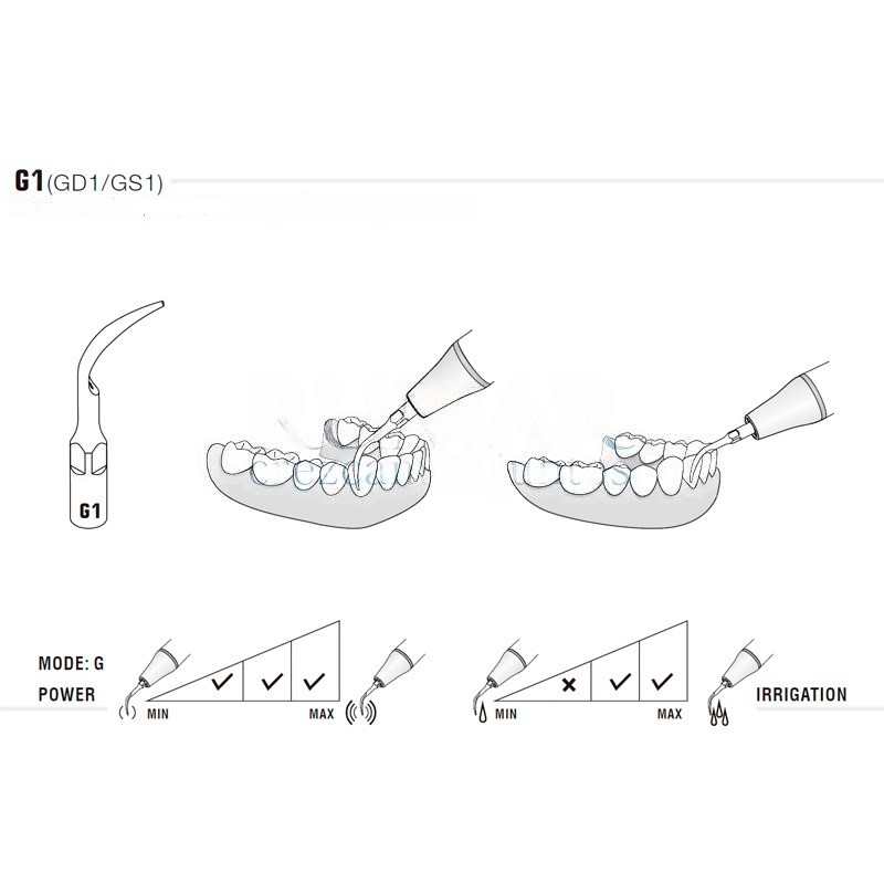 Woodpecker GD1T ultrasonic tip compatible with Satelec | Prophylaxis, Titanium Treatment