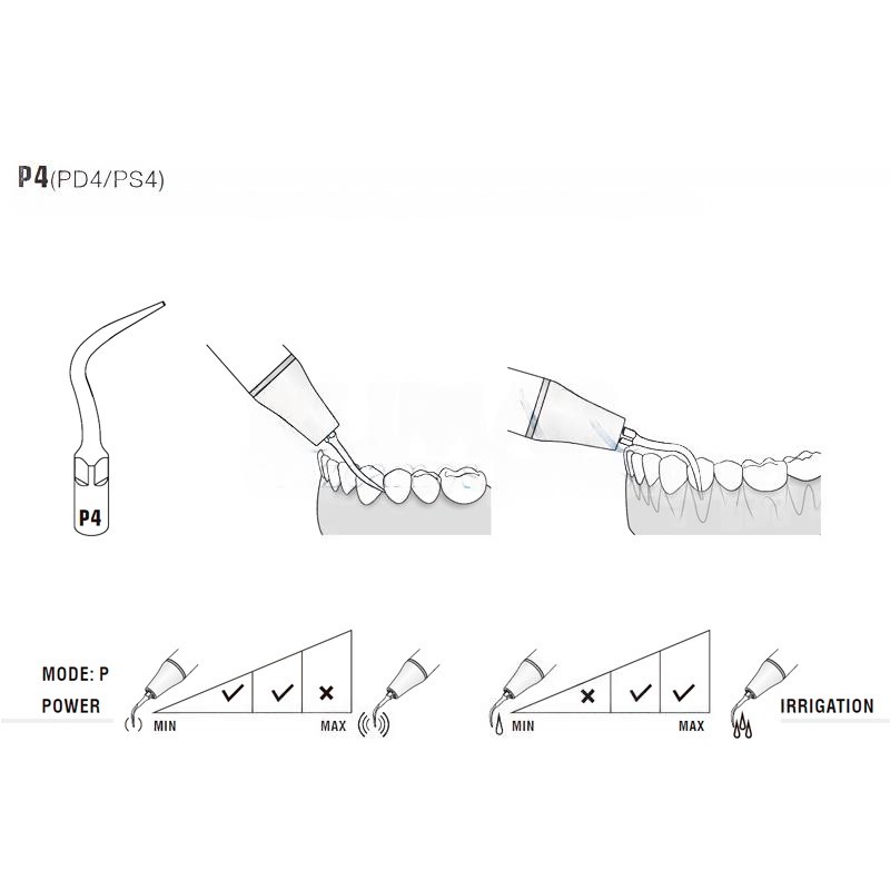 Diamond Ultrasonic Tip Woodpecker PS4D Compatible with Sirona | Perio