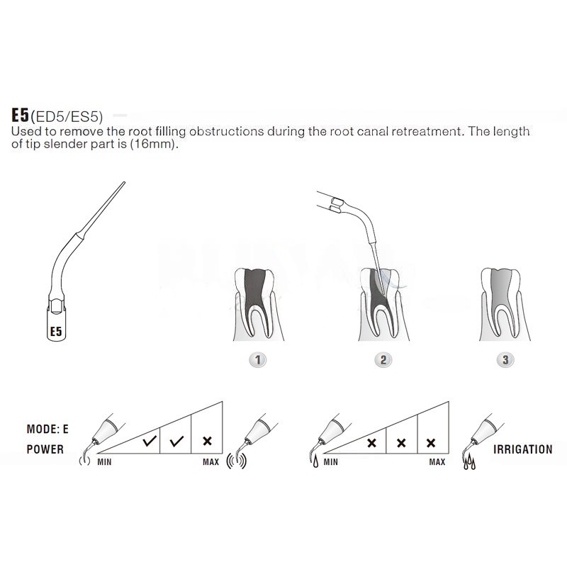 Woodpecker ES5 ultrasonic tip compatible with SIRONA | Endo