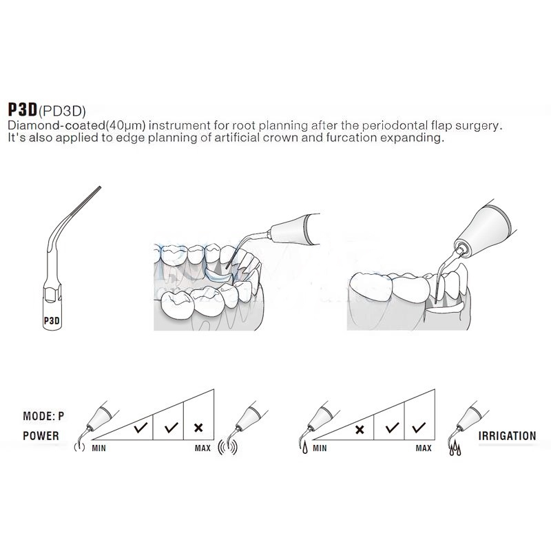 Woodpecker PD3D ultrasonic tip compatible with Satelec | Perio, Diamond