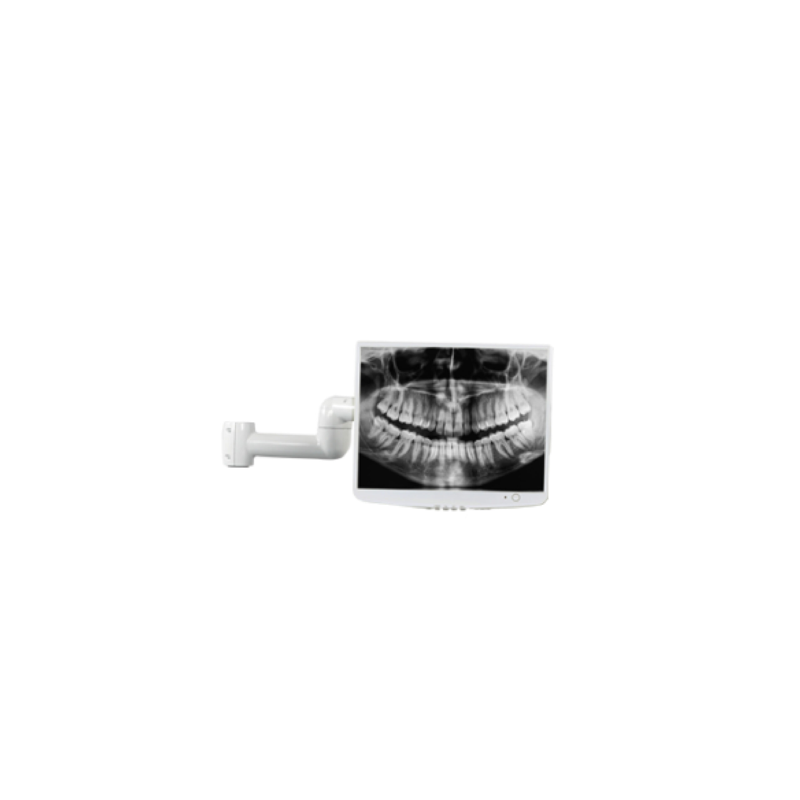 Arm for VEO-D monitor