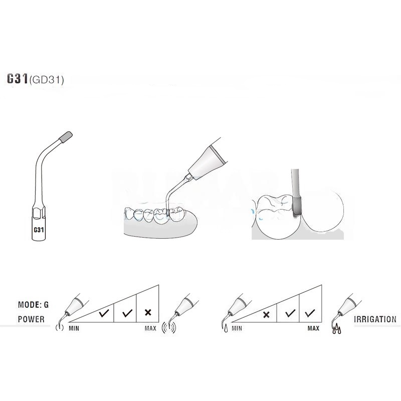 Ultrasonic Tip Woodpecker GD31 Compatible With Satelec | Prophylaxis Diamond Carving