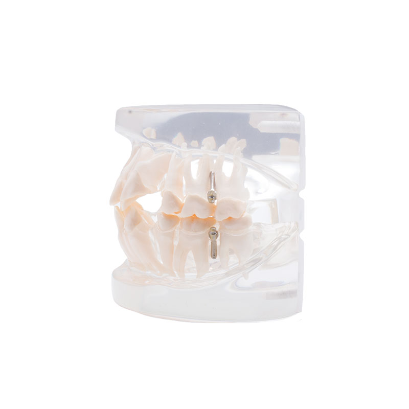 Bader orthodontic practice model